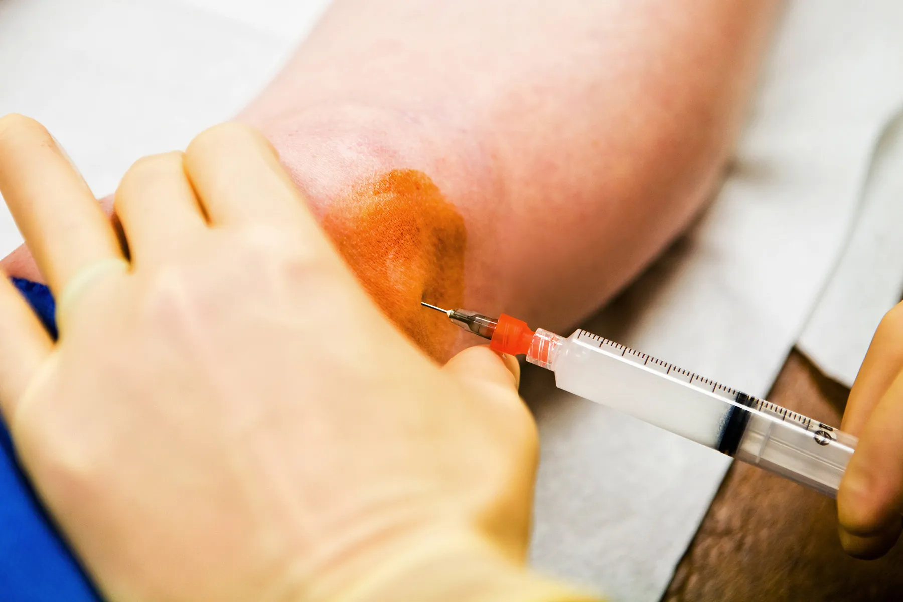 Cortisone Shot: Uses, Side Effects, & More